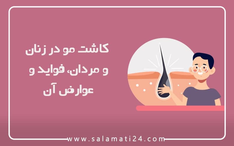 Hair transplantation in men and women: its benefits and side effects